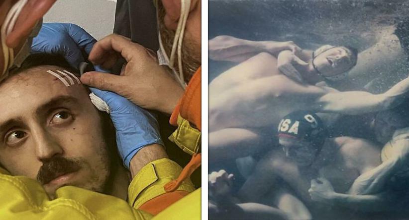 20 Fotos acidentais que ficaram muito parecidas com pinturas